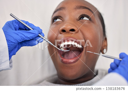 Dentist hands, patient mouth and tools, check teeth for dental health and medical treatment. Oral hygiene, healthcare and orthodontics, black woman with tooth decay and clean for cavity and excavator 138183676