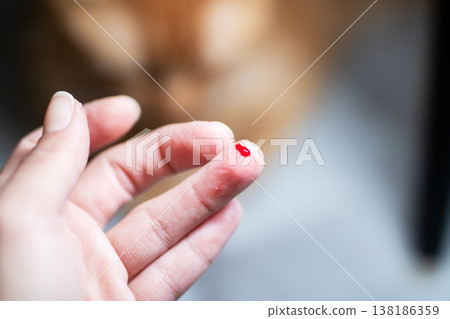 Intimate scene of self testing blood glucose with gentle sheen and blurry cat silhouette 138186359