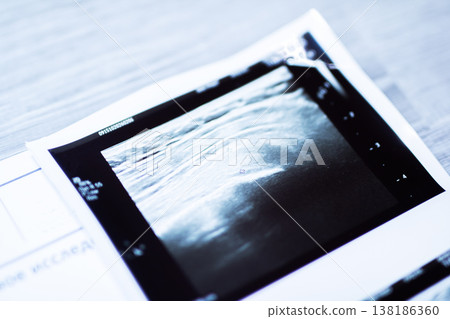 Medical sonogram photograph portraying fetal profile with clinical borders and emotional tone 138186360