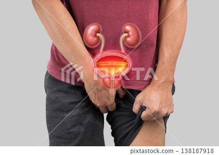 Man with Symptoms of Benign Prostatic Hyperplasia (BPH) or Enlarged Prostate 138187918