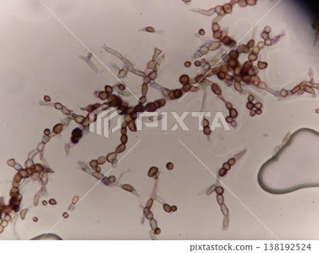 廚房矽膠上生長的黑色黴菌的顯微圖像。 138192524