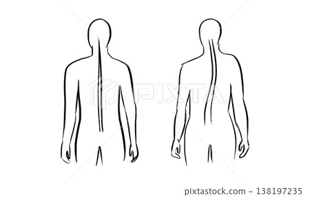 Scoliosis spine deformity 138197235