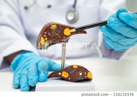 Liver with gallbladder, pancreas spleen and duodenum, Asian doctor holding human anatomy model for study diagnosis and treatment in hospital. 138210336