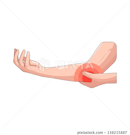 Illustration of Elbow pain Illustration of Elbow pain 138215887