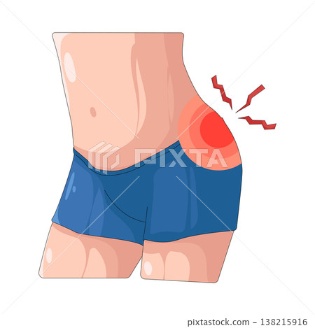 Illustration of Buttock pain Illustration of Buttock pain 138215916