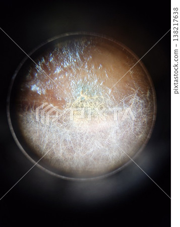 在立體顯微鏡下觀察到的黴菌生長狀態。 138217638
