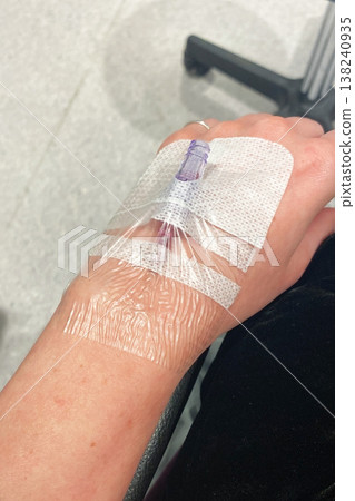 Close-up of an IV Cannula in a Patient's Hand 138240935