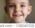 Close-up portrait of smiling young boy with a scratch on his face 138242316