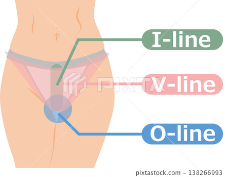 VIO脫毛示意圖 138266993