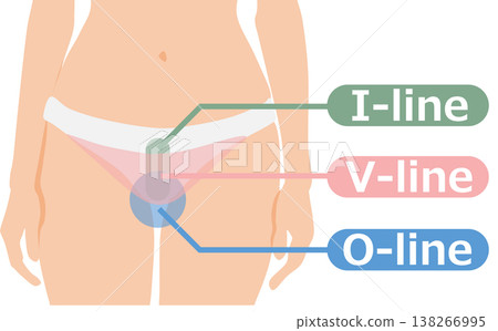 VIO脫毛示意圖 138266995