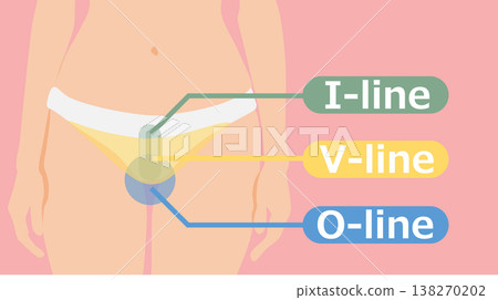 VIO脫毛示意圖 138270202