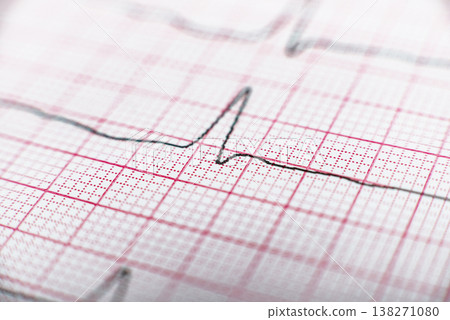 Health care background of Electrocardiogram plot Health care background of Electrocardiogram plot 138271080