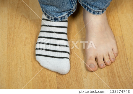 Comparison of womens feet with and without socks. Selection of comfortable socks for foot health Comparison of womens feet with and without socks. Selection of comfortable socks for foot health 138274748
