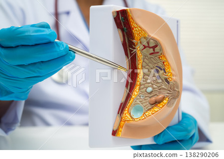 doctor holding female breast human anatomy model. doctor holding female breast human anatomy model. 138290206