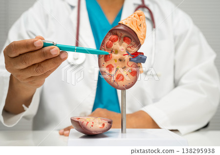 Chronic kidney disease, doctor with model for treatment urinary system, urology, Estimated glomerular filtration rate eGFR. Chronic kidney disease, doctor with model for treatment urinary system, urology, Estimated glomerular filtration rate eGFR. 138295938