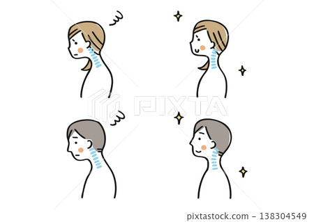 圖示對比直頸與正常姿勢（男性和女性組①） 138304549