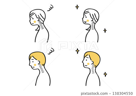 圖示對比直頸與正常姿勢（男女組，第二部分） 138304550