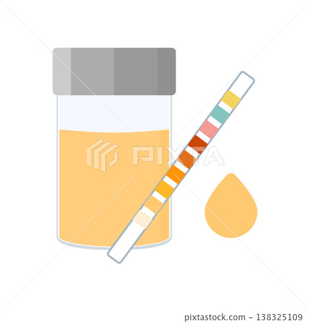 Urine sample cup and urinalysis reagent strip for kidney exam, urinary tract infection and cystitis diagnostics. Urine sample cup and urinalysis reagent strip for kidney exam, urinary tract infection and cystitis diagnostics. 138325109