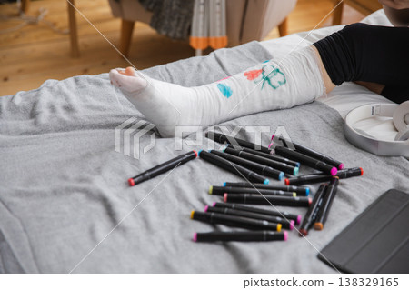 Woman hands drawing on broken leg cast. Unrecognizable girl draws with felt tip pens on orthopedic cast. Bored girl with broken leg playing at home during rehabilitation. Accident injury fracture Woman hands drawing on broken leg cast. Unrecognizable girl draws with felt tip pens on orthopedic cast. Bored girl with broken leg playing at home during rehabilitation. Accident injury fracture 138329165