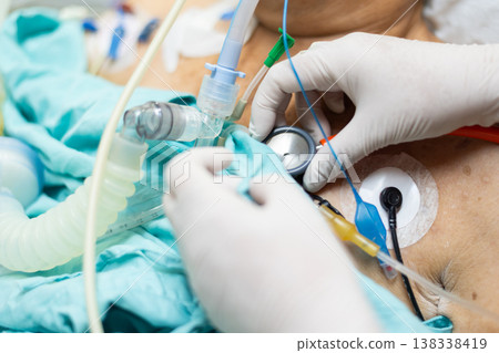 Closeup of patient chest with medical sensors stethoscope and ventilator tubing showing intensive care monitoring emergency treatment and life support in hospital environment Closeup of patient chest with medical sensors stethoscope and ventilator tubing showing intensive care monitoring emergency treatment and life support in hospital environment 138338419