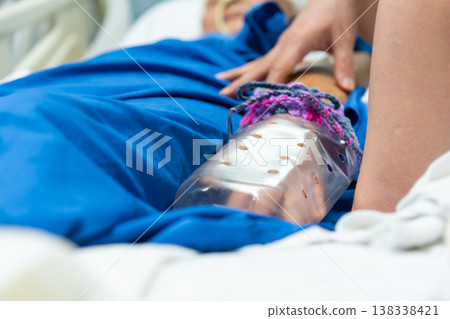 Close up of patient arm with protective cast and medical support device resting on hospital bed showing injury treatment recovery care and rehabilitation process in clinical setting Close up of patient arm with protective cast and medical support device resting on hospital bed showing injury treatment recovery care and rehabilitation process in clinical setting 138338421