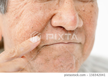 Senior men with nasolabial folds Senior men with nasolabial folds 138342041