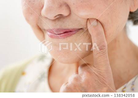 Senior woman nasolabial folds 138342058