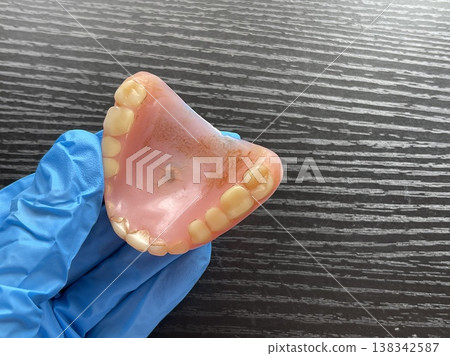 Inner Palatal Surface Of Old Denture With Brown Stains Inner Palatal Surface Of Old Denture With Brown Stains 138342587