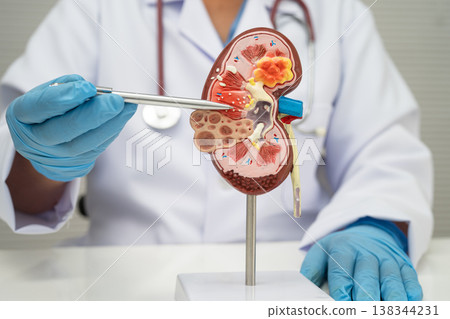Chronic kidney disease, doctor with model for treatment urinary system, urology, Estimated glomerular filtration rate eGFR. 138344231