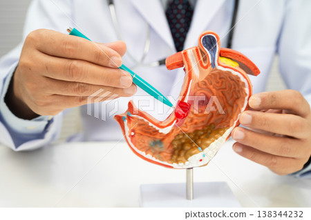 Stomach disease, doctor holding anatomy model for study diagnosis and treatment in hospital. 138344232