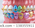 human teeth model with colorful dental braces. 138355911