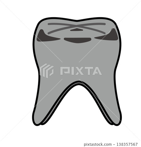 Illustration of a molar with a silver filling and decay / Dentistry and dental care Illustration of a molar with a silver filling and decay / Dentistry and dental care 138357567