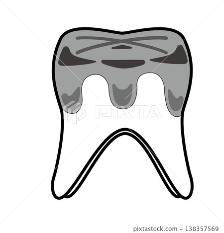 Illustration of a molar with a silver filling and decay / Dentistry and dental care 138357569