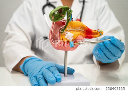 Pancreatitis, pancreatic cancer, Asian doctor with pancreas, gallbladder and bile duct human model. Pancreatitis, pancreatic cancer, Asian doctor with pancreas, gallbladder and bile duct human model. 138403135