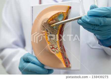 Doctor holding female breast human anatomy model. Doctor holding female breast human anatomy model. 138430273