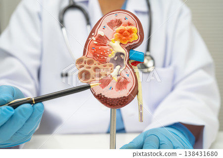 Chronic kidney disease, doctor with model for treatment urinary system. 138431680