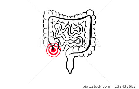 Inflamed appendix scetch Inflamed appendix scetch 138432692