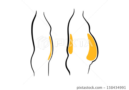 Body mass index Body mass index 138434991