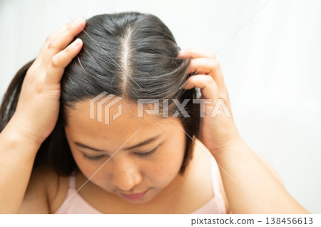 Asian women have problems with itchy scalp and dandruff. Asian women have problems with itchy scalp and dandruff. 138456613