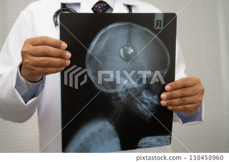 Doctor examining brain radiography xray film. Doctor examining brain radiography xray film. 138458960