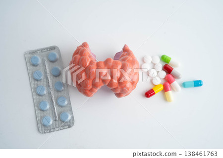 Thyroid model with pill drug treatment, Hyperthyroidism, Overactive or Lymphoma. Thyroid model with pill drug treatment, Hyperthyroidism, Overactive or Lymphoma. 138461763