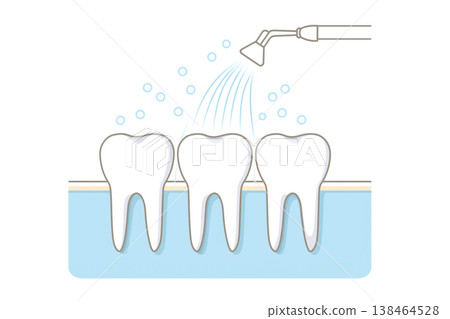 Illustration of a dental irrigator cleaning between teeth 138464528