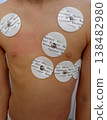 Petropavlovsk, Kazakhstan - November 11, 2025: Medical electrodes attached to a child's chest. 138482980