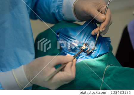 dentist performing tooth procedure with rubber dam isolation and instruments in sterile clinic closeup of hands tools and treated tooth in oral healthcare setting 138483185