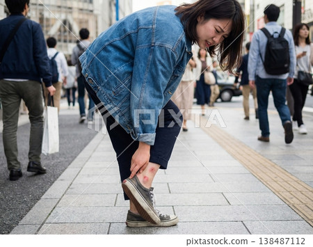 假期外出時發生的一件意想不到的事：在街上突然感到皮膚發紅發癢。 138487112