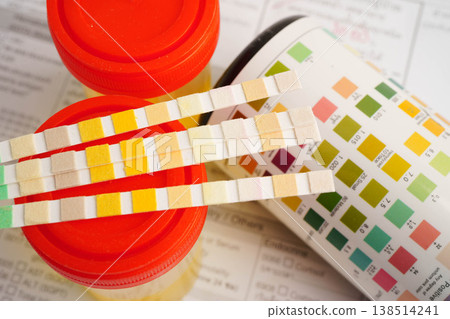 Urinalysis, urine cup with reagent strip pH paper test and comparison chart in laboratory. 138514241