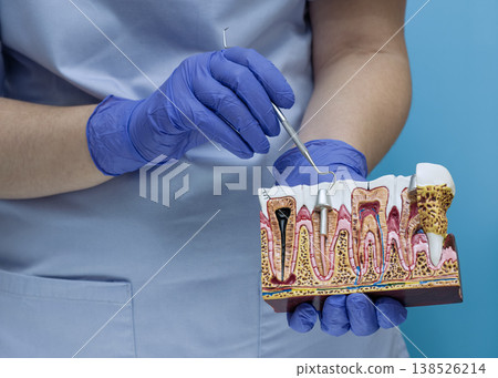 Dentist showing root canal treatment and dental anatomy on a cross-section gum model with professional probe. Dentist showing root canal treatment and dental anatomy on a cross-section gum model with professional probe. 138526214