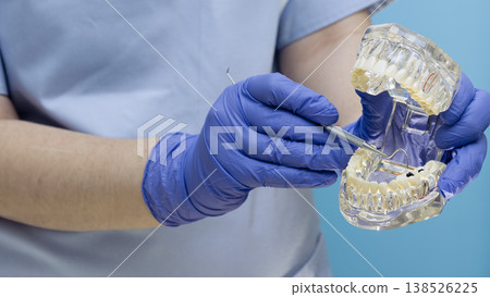 Dentist hands in blue gloves holding transparent dental typodont model and pointing at tooth decay with an explorer. Dentist hands in blue gloves holding transparent dental typodont model and pointing at tooth decay with an explorer. 138526225