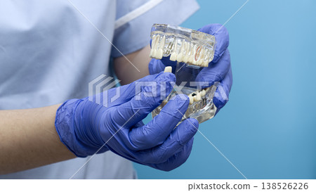 Dentist in blue gloves demonstrating a dental implant and artificial crown on a transparent jaw model. Dentist in blue gloves demonstrating a dental implant and artificial crown on a transparent jaw model. 138526226