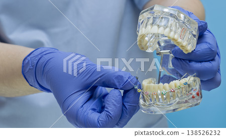 Braces installation and bite correction concept. Doctor holding clear teeth model with colorful brackets. Braces installation and bite correction concept. Doctor holding clear teeth model with colorful brackets. 138526232